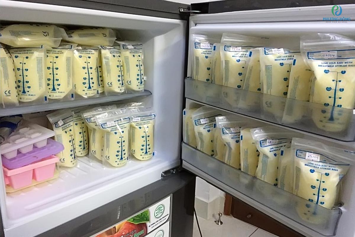 Sữa mẹ bảo quản trong tủ đông với thời gian là 6 đến 12 tháng