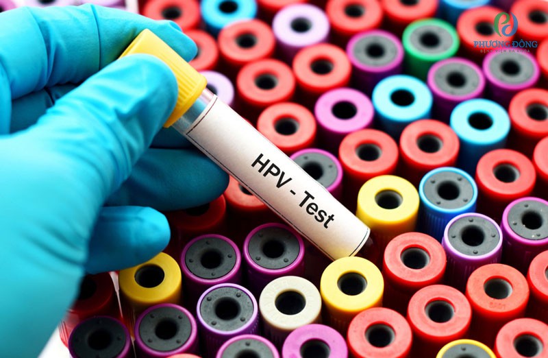 Vắc xin HPV đạt hiệu quả nhất khi cơ thể chưa phơi nhiễm với virus