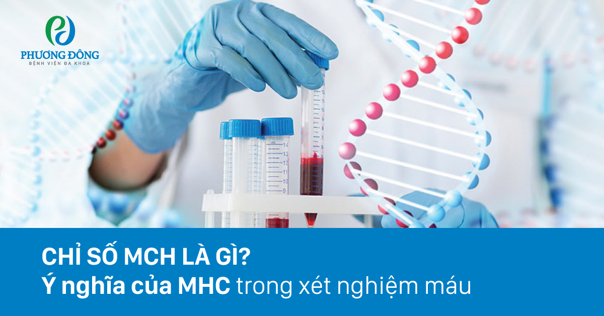 Chỉ số MCH trọng xét nghiệm máu là gì?