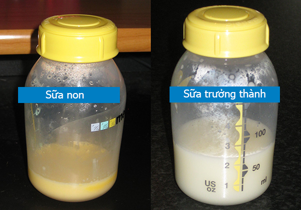Hình ảnh sữa non khi so sánh với sữa trưởng thành.