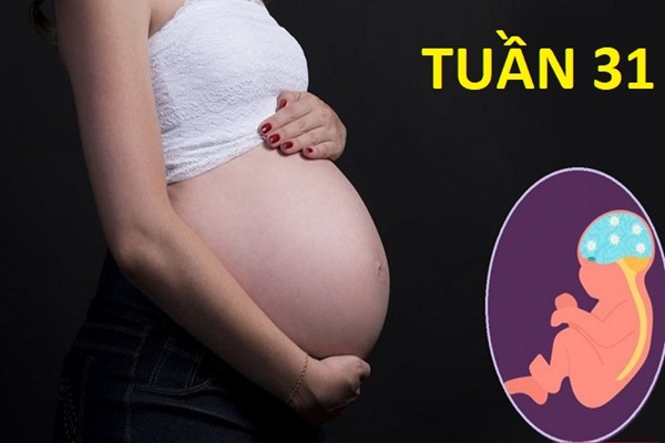 Ối vỡ non tuần 22-31 sẽ được can thiệp dưỡng thai để kéo dài thai kỳ