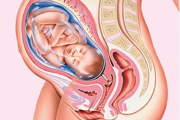 Vỡ ối non tuần 37 sẽ được chỉ định chấm dứt thai kỳ