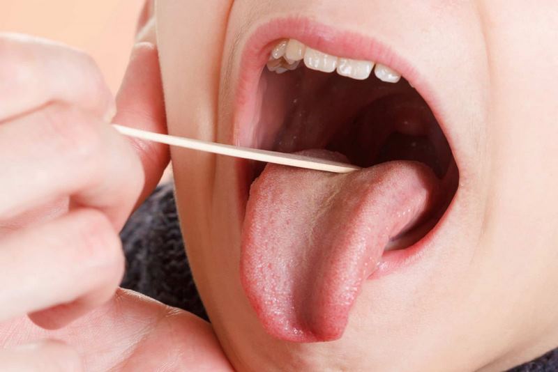 Viêm họng xuất huyết có nguy hiểm không? 
