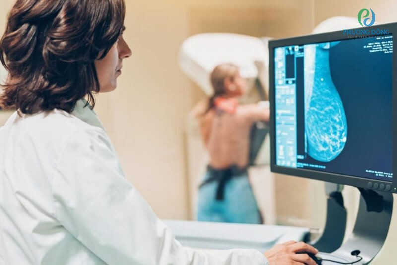 X-quang tim phổi là xét nghiệm giúp tìm được thay đổi kích thước tim