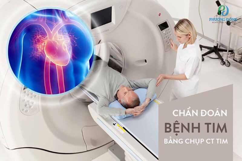 Chụp CT scan tim giúp tìm ra sự dày lên của tim và loại bỏ các nguyên nhân