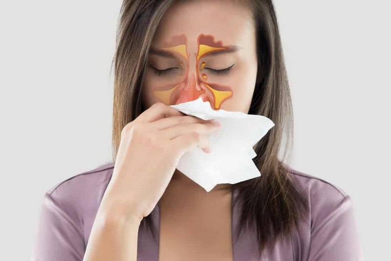 Dịch trong căn bệnh này có thể chảy xuống họng gây tình trạng hôi miệng