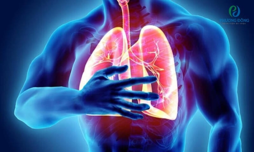 Tìm hiểu về ung thư phổi - Căn bệnh nguy hiểm trên thế giới