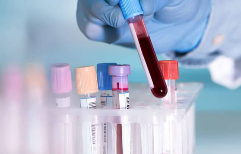 xét nghiệm máu được tiến hành để đánh giá độ thiếu máu