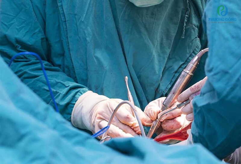 phẫu thuật cắt bỏ tuyến tiền liệt để tế bào ung thư không lan rộng
