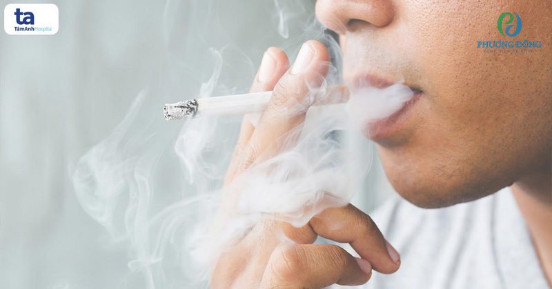 Hút thuốc lá có nguy cơ mắc bệnh tăng từ 20-30% so với người thường
