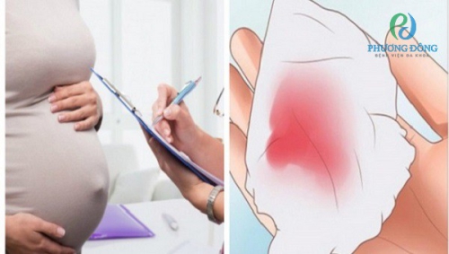 Ra dịch nhầy màu hồng bao lâu thì sinh?