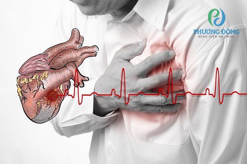 Nhồi máu cơ tim có nguy cơ tử vong rất cao ở bất cứ lứa tuổi nào