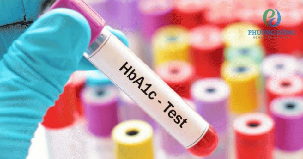 Khi đo HbA1c đường huyết ở mức dưới 6,5% là bình thường
