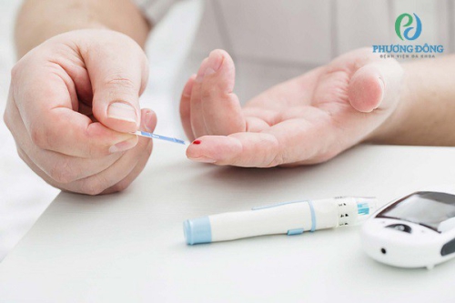 Bệnh tiểu đường có di truyền không và phương pháp phòng tránh 