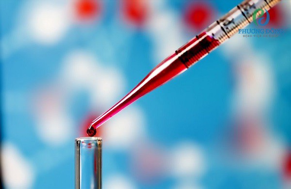 Xét nghiệm tuyến giáp bằng xét nghiệm máu đưa kết quả chính xác