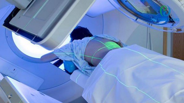 Liệu pháp tia xạ ngoài phát ra chùm tia sáng từ bên ngoài đến khối u