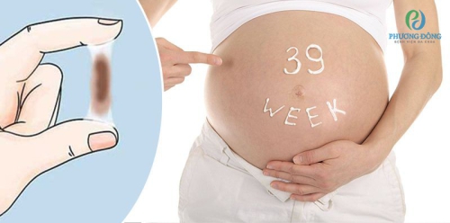 Mẹ bầu ra máu báo sắp sinh màu nâu có phải sắp chuyển dạ không?