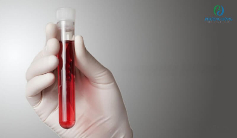 Xét nghiệm máu để xác định có virus xâm nhập vào xương máu không