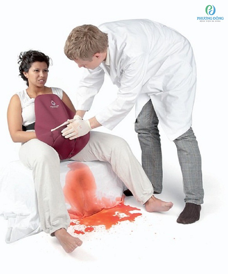 Băng huyết sau sinh chiếm tỉ lệ cao gây ra cái chết ở sản phụ