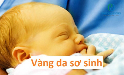 Vàng da sơ sinh: Nguyên nhân, cách điều trị và lời khuyên cho cha mẹ