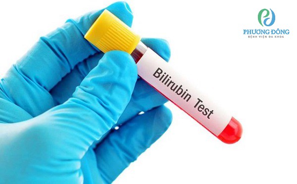 Nguyên nhân chính gây bệnh là do nồng độ bilirubin tăng cao
