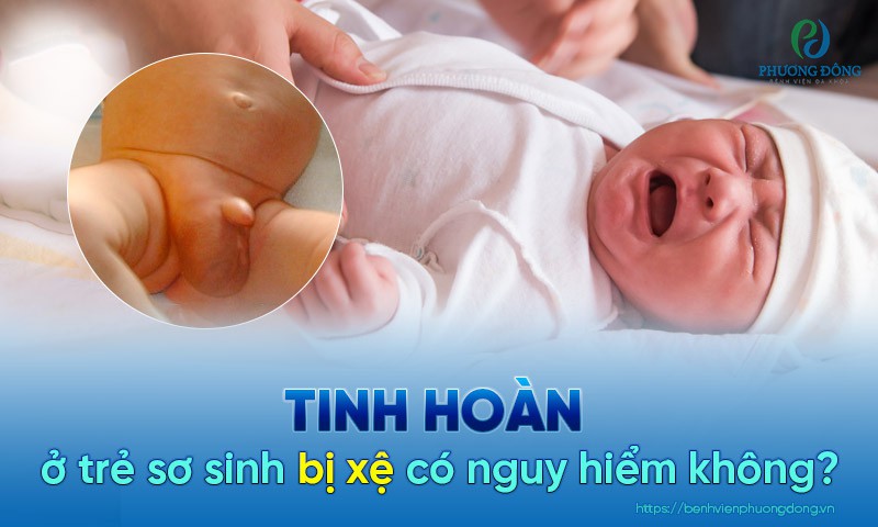 HÌNH ẢNH VIÊM TINH HOÀN Ở TRẺ EM CHO THẤY BÌU SƯNG ĐỎ ĐAU CÓ THỂ ẢNH HƯỞNG ĐẾN SỨC KHỎE SINH SẢN NẾU KHÔNG ĐIỀU TRỊ
