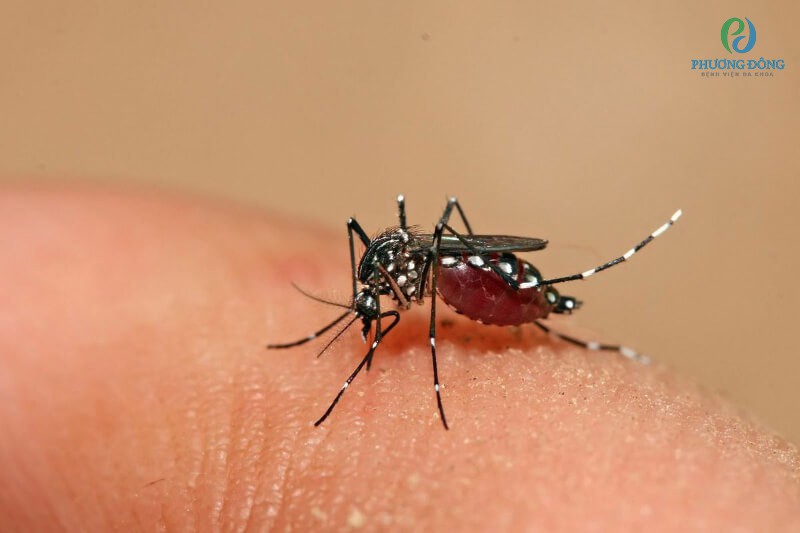 Nguyên nhân chủ yếu do muỗi vằn đốt lây truyền virus sang người bệnh