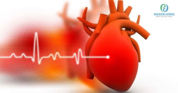 Suy tim độ 4 - Cấp độ nguy hiểm cuối cùng của bệnh suy tim