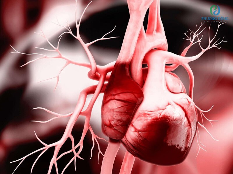 Suy tim sung huyết là biểu hiện của tim hoạt động kém hiệu quả
