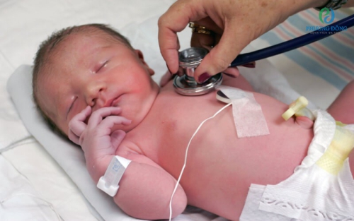 Suy tim ở trẻ em: Nguyên nhân và cách điều trị hiệu quả