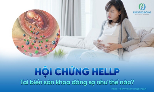 Hội chứng HELLP - Tai biến sản khoa nguy hiểm ở mẹ bầu
