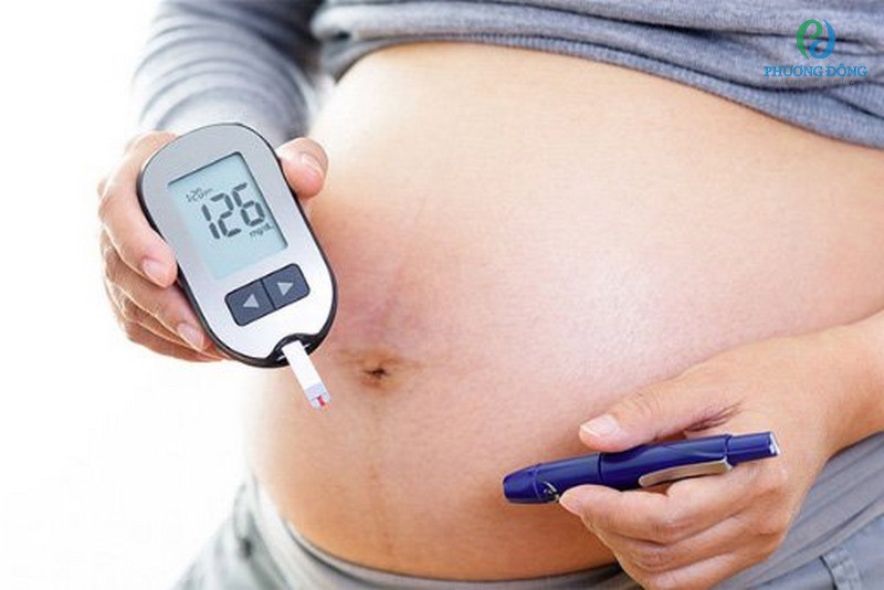 Mang thai từ tuần 24 đến tuần 28 nên làm xét nghiệm tiểu đường thai kỳ