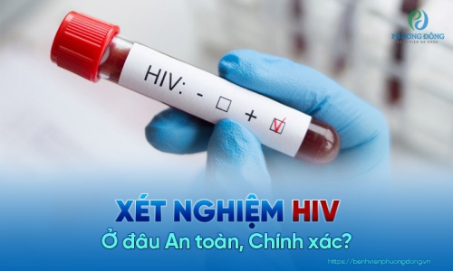 Tìm hiểu về phương pháp xét nghiệm HIV phổ biến hiện nay