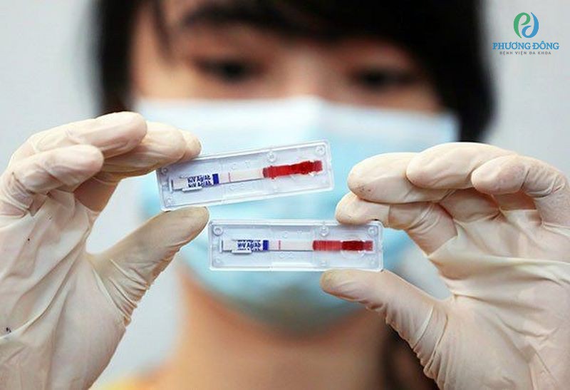 Có nhiều phương pháp để thực hiện xét nghiệm HIV