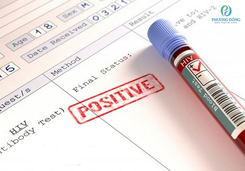 Khách hàng bị nhiễm HIV khi có kết quả dương tính