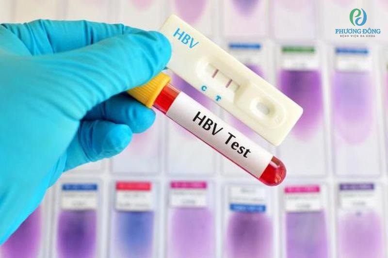 Xét nghiệm HBsAg có thể xác định cơ thể có nhiễm virus viêm gan B không