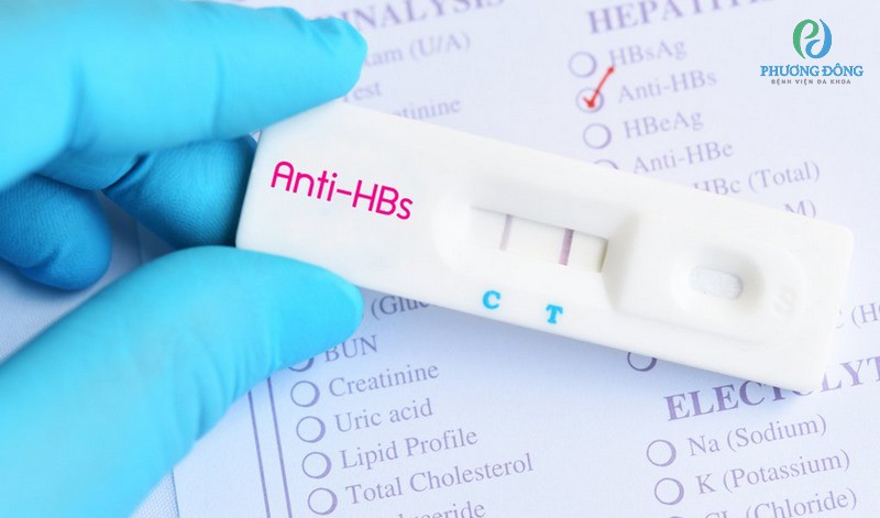 Xét nghiệm Anti-HBs để kiểm tra khả năng miễn dịch với virus viêm gan B