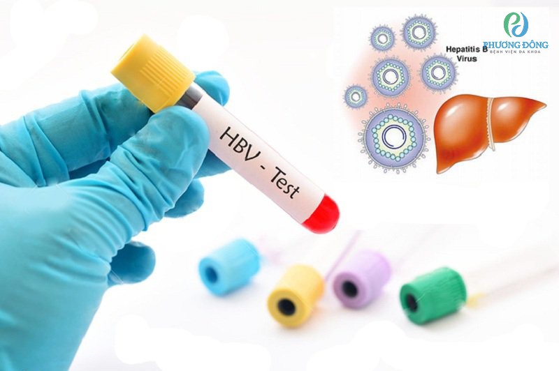 Xét nghiệm Anti-HBc IgM để xác định rõ giai đoạn của bệnh viêm gan B