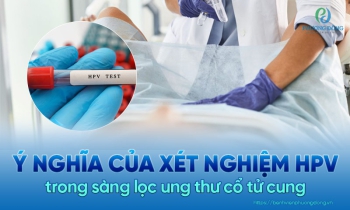 Xét nghiệm HPV là gì? Cách thực hiện phương pháp hiệu quả