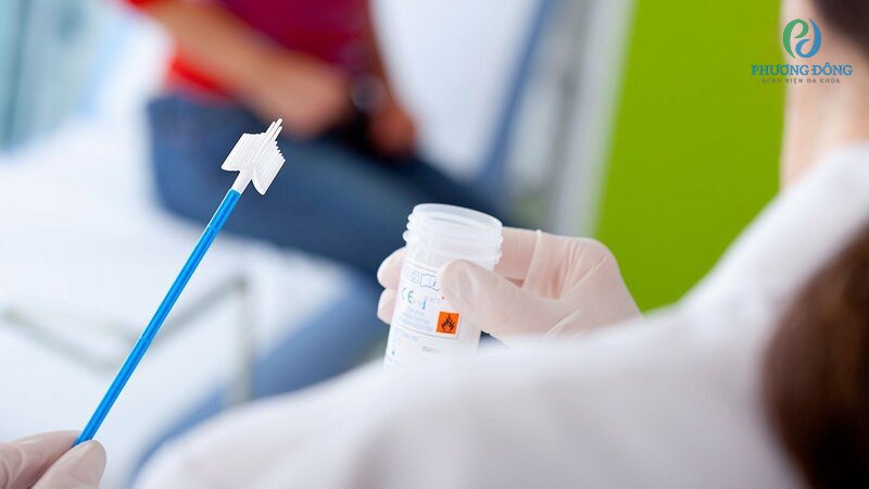 Cần tuần thủ đầy đủ quy trình xét nghiệm nhiễm HPV để có kết quả chính xác