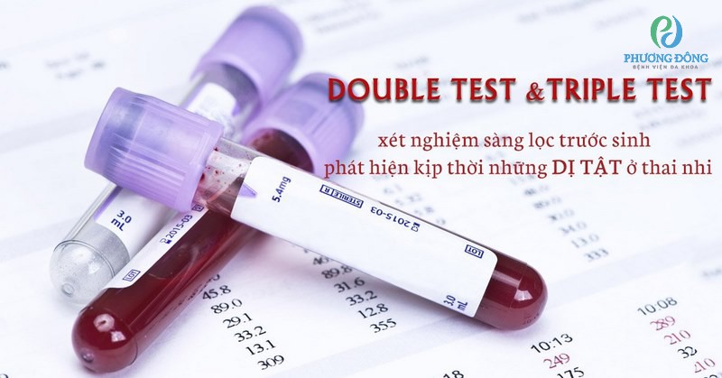 Xét nghiệm Double test để sàng lọc nguy cơ dị tật ở thai nhi
