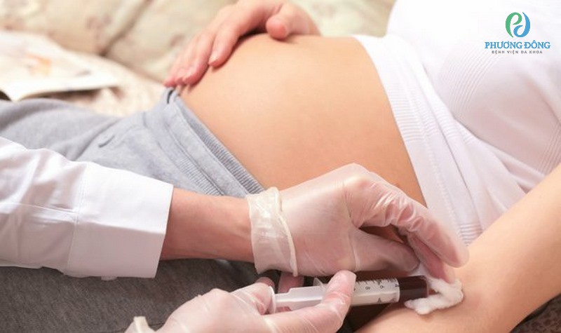 Double test là xét nghiệm phát hiện sự bất thường về sức khỏe của thai nhi