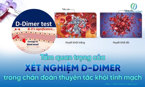 Tìm hiểu về phương pháp xét nghiệm D-dimer phổ biến 
