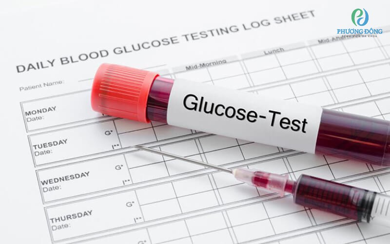 Xét nghiệm lượng đường trong máu để biết được chỉ số Glucose trong máu