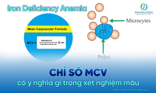 Chỉ số mcv là gì? Đạt mức bao nhiêu là bình thường