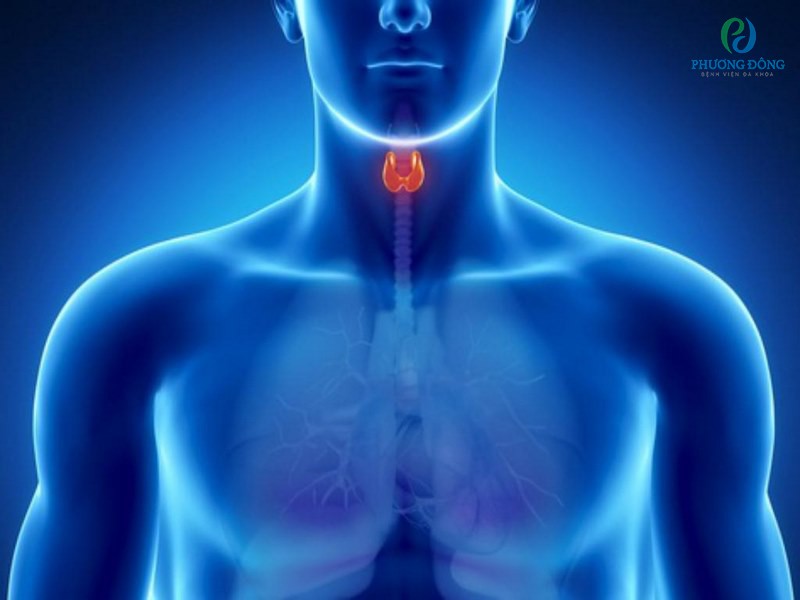 Di căn hạch là khối u ác tính đã lan rộng tới các hạch bạch huyết ở cổ