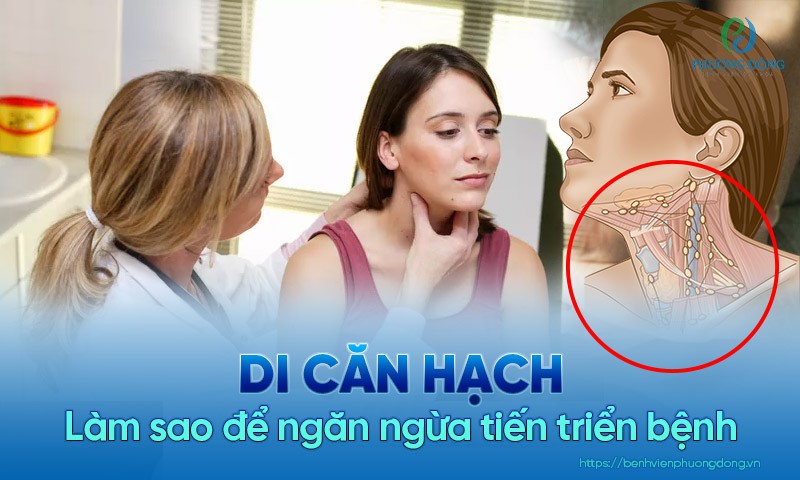 Các yếu tố nguy cơ gây ra ung thư hạch di căn là gì?
