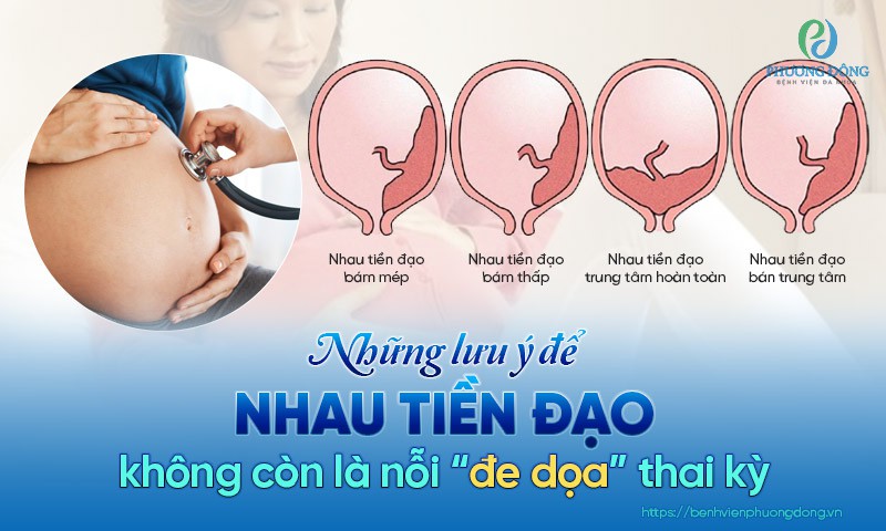 10 món ăn bị nhau tiền đạo kiêng an gì giúp phòng tránh bệnh tật hiệu quả