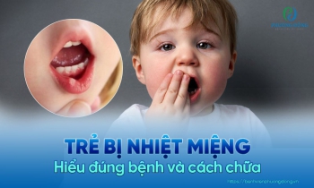 Bí kíp trị nhiệt miệng ở trẻ em hiệu quả mà cha mẹ cần biết