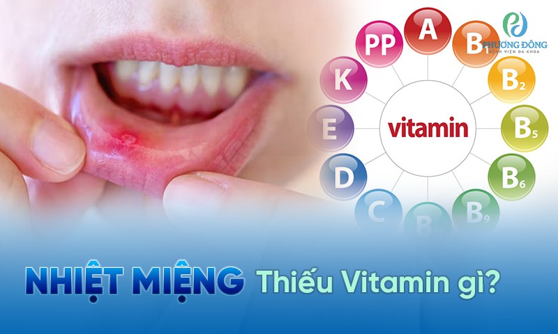 Lở miệng thiếu vitamin gì? Vì sao thiếu vitamin có thể gây ra nhiệt miệng?
